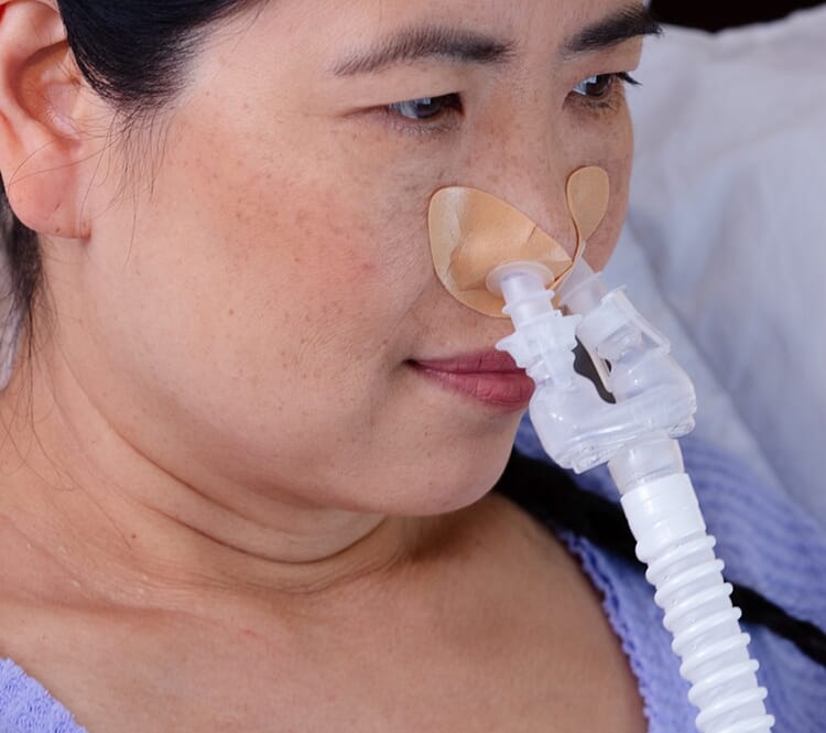 Nasal Direct CPAP Masks